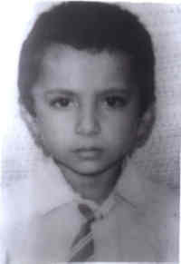 Fig. 1. Facial appearance of patient at 6 years of age. 