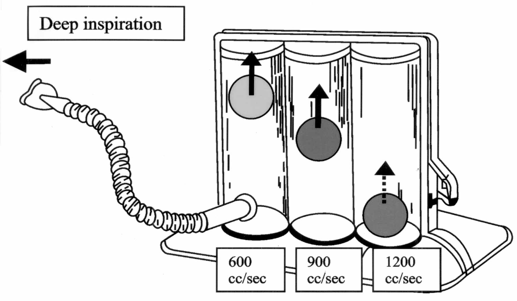 Autogenic Drainage - Physiopedia